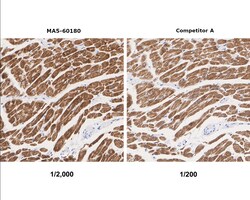 Invitrogen MYH7 Recombinant Rabbit Monoclonal Antibody (PSH07-54) 100 &mu;L;