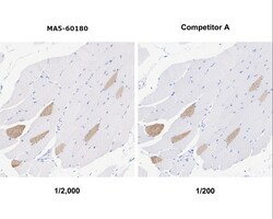 Invitrogen MYH7 Recombinant Rabbit Monoclonal Antibody (PSH07-54) 100 &mu;L;