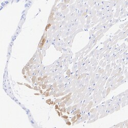 Invitrogen MYH7 Recombinant Rabbit Monoclonal Antibody (PSH07-54) 100 &mu;L;
