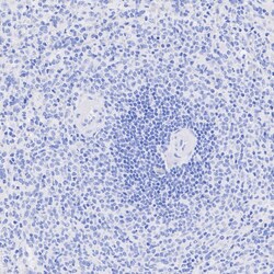 Invitrogen MYH7 Recombinant Rabbit Monoclonal Antibody (PSH07-54) 100 &mu;L;