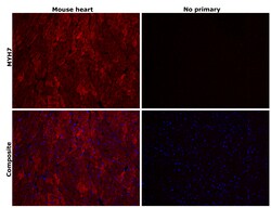 Invitrogen MYH7 Recombinant Rabbit Monoclonal Antibody (PSH07-54) 100 &mu;L;