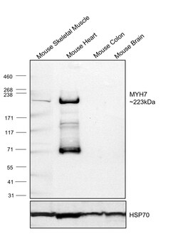 Invitrogen MYH7 Recombinant Rabbit Monoclonal Antibody (PSH07-54) 100 &mu;L;