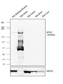 Invitrogen MYH7 Recombinant Rabbit Monoclonal Antibody (PSH07-54) 100 &mu;L;