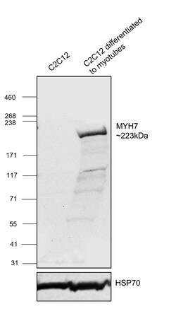 Invitrogen MYH7 Recombinant Rabbit Monoclonal Antibody (PSH07-54) 100 &mu;L;