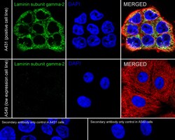 Invitrogen Laminin gamma-2 Recombinant Rabbit Monoclonal Antibody (PSH07-27)