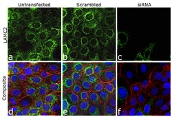 Invitrogen Laminin gamma-2 Recombinant Rabbit Monoclonal Antibody (PSH07-27)