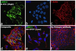 Invitrogen Laminin gamma-2 Recombinant Rabbit Monoclonal Antibody (PSH07-27)