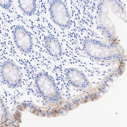 Invitrogen Laminin gamma-2 Recombinant Rabbit Monoclonal Antibody (PSH07-27)