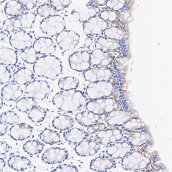 Invitrogen Laminin gamma-2 Recombinant Rabbit Monoclonal Antibody (PSH07-27)