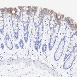 Invitrogen Laminin gamma-2 Recombinant Rabbit Monoclonal Antibody (PSH07-27)