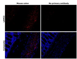 Invitrogen Laminin gamma-2 Recombinant Rabbit Monoclonal Antibody (PSH07-27)