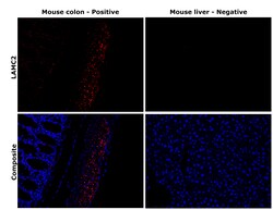 Invitrogen Laminin gamma-2 Recombinant Rabbit Monoclonal Antibody (PSH07-27)
