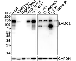 Invitrogen Laminin gamma-2 Recombinant Rabbit Monoclonal Antibody (PSH07-27)
