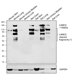 Invitrogen Laminin gamma-2 Recombinant Rabbit Monoclonal Antibody (PSH07-27)
