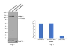 Invitrogen Laminin gamma-2 Recombinant Rabbit Monoclonal Antibody (PSH07-27)