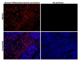 Invitrogen BRCA2 Recombinant Rabbit Monoclonal Antibody (PSH07-55) 100