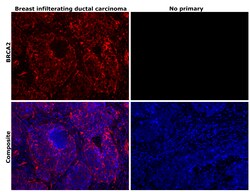 Invitrogen BRCA2 Recombinant Rabbit Monoclonal Antibody (PSH07-55) 100