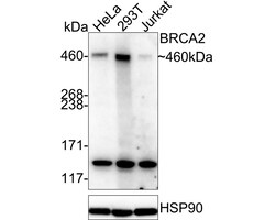 Invitrogen BRCA2 Recombinant Rabbit Monoclonal Antibody (PSH07-55) 100