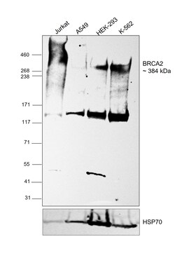 Invitrogen BRCA2 Recombinant Rabbit Monoclonal Antibody (PSH07-55) 100