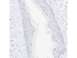 Invitrogen RAR gamma-1 Recombinant Rabbit Monoclonal Antibody (PSH07-19)
