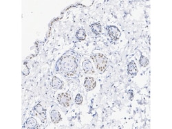 Invitrogen RAR gamma-1 Recombinant Rabbit Monoclonal Antibody (PSH07-19)