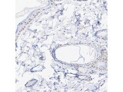 Invitrogen RAR gamma-1 Recombinant Rabbit Monoclonal Antibody (PSH07-19)