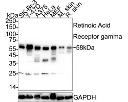 Invitrogen RAR gamma-1 Recombinant Rabbit Monoclonal Antibody (PSH07-19)