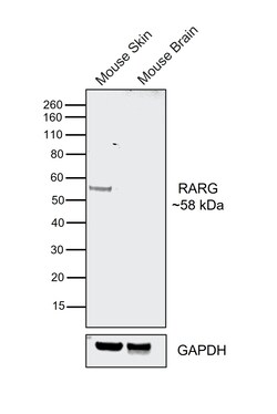 Invitrogen RAR gamma-1 Recombinant Rabbit Monoclonal Antibody (PSH07-19)