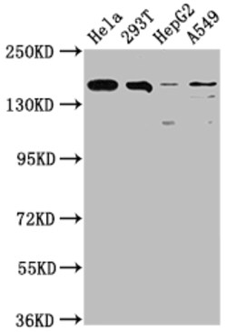 Invitrogen BRD4 Recombinant Rabbit Monoclonal Antibody (1E5) 100 &mu;L;