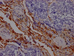 Invitrogen ICAM-1 Recombinant Rabbit Monoclonal Antibody (3E9) 100 &mu;L;