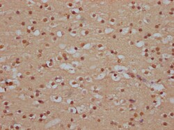 Invitrogen SOX10 Recombinant Rabbit Monoclonal Antibody (8E1) 100 &mu;L;