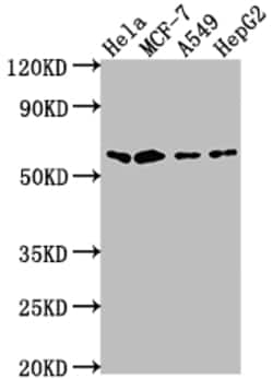 Invitrogen SOX10 Recombinant Rabbit Monoclonal Antibody (8E1) 100 &mu;L;