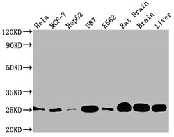 Invitrogen SOD2 Recombinant Rabbit Monoclonal Antibody (10F6) 100 &mu;L;