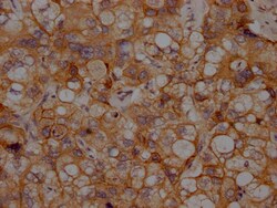 Invitrogen N-cadherin Recombinant Rabbit Monoclonal Antibody (1A9) 100