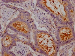 Invitrogen CEACAM1 Recombinant Rabbit Monoclonal Antibody (10H8) 100 &mu;L;