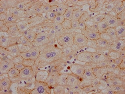 Invitrogen CEACAM1 Recombinant Rabbit Monoclonal Antibody (10H8) 100 &mu;L;