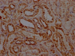 Invitrogen STAT6 Recombinant Rabbit Monoclonal Antibody (2F10) 100 &mu;L;