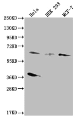 Invitrogen SMAD4 Recombinant Rabbit Monoclonal Antibody (22H12) 100 &mu;L;