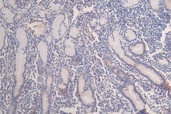 Invitrogen H3K18ac Recombinant Rabbit Monoclonal Antibody (30A7) 100 &mu;L;