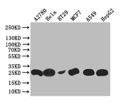 Invitrogen WFDC2 Recombinant Rabbit Monoclonal Antibody (17D2) 100 &mu;L;