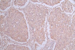 Invitrogen&trade;&nbsp;CD155 Recombinant Rabbit Monoclonal Antibody (19C12)