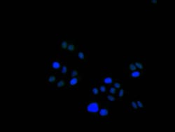 Invitrogen&trade;&nbsp;HMGB1 Recombinant Mouse Monoclonal Antibody (1E7)