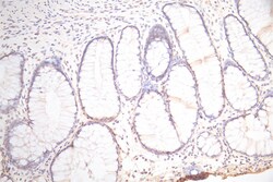 Invitrogen Podoplanin Recombinant Mouse Monoclonal Antibody (34B4) 100