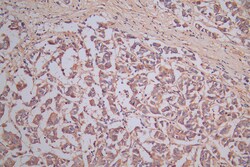 Invitrogen CRMP2 Recombinant Rabbit Monoclonal Antibody (1A1) 100 &mu;L;