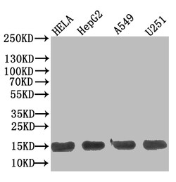 Invitrogen TRAIL-R2 (DR5) Recombinant Human Monoclonal Antibody (11E11)
