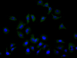 Invitrogen ASCT2 Recombinant Human Monoclonal Antibody (4G12) 100 &mu;L;