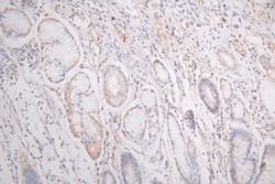 Invitrogen VEGF Receptor 1 Recombinant Human Monoclonal Antibody (6F6) 100 &mu;L | Buy Online | Invitrogen&trade; | Fisher Scientific