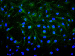 Invitrogen FGF1 Recombinant Mouse Monoclonal Antibody (23H4) 100 &mu;L;