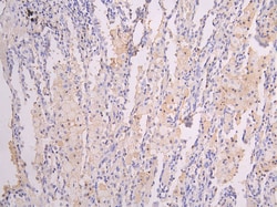 Invitrogen ICAM-1 Recombinant Human Monoclonal Antibody (15A9) 100 &mu;L;