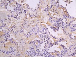 Invitrogen FGFR2 Recombinant Human Monoclonal Antibody (18D12) 100 &mu;L;